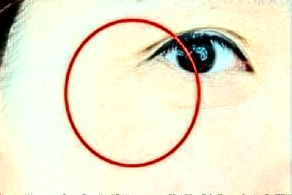 2024杭州三甲开内眼角多少钱啊?开内眼角多久恢复自然?