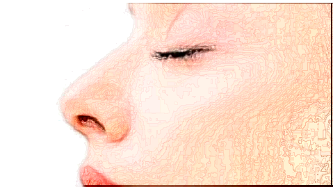 2024收费价格表_手术需要多久