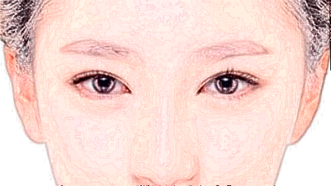 玻尿酸丰太阳穴危险吗_2024玻尿酸丰太阳穴价格表