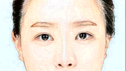 祛斑小妙招(9月更新)_2024祛斑收费价目表