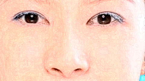 去泪沟价格表(2024年9月抢先)_怎么消除泪沟