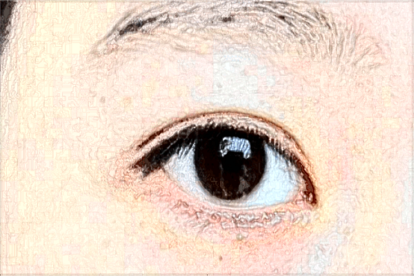 2024眼部整形价格表_保定华美眼部整形怎么样