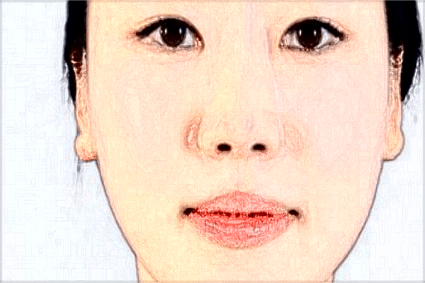 保定华美激光祛斑价目表(价格表)怎么样