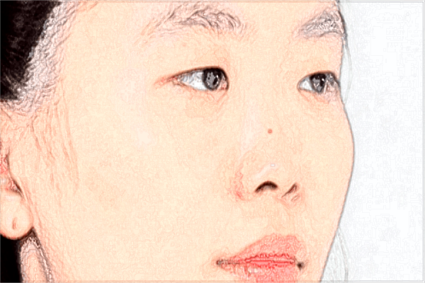 2024北京美莱热玛吉价格表_北京美莱热玛吉好吗