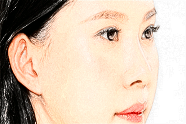 上睑提肌有哪些注意事项?上睑提肌术价目表?