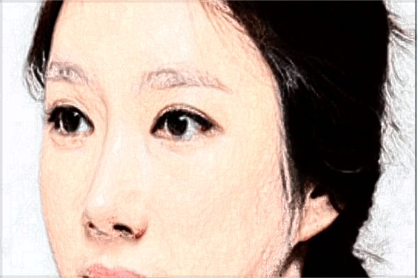 南医大友谊面部年轻化收费价格表(价目表)一览