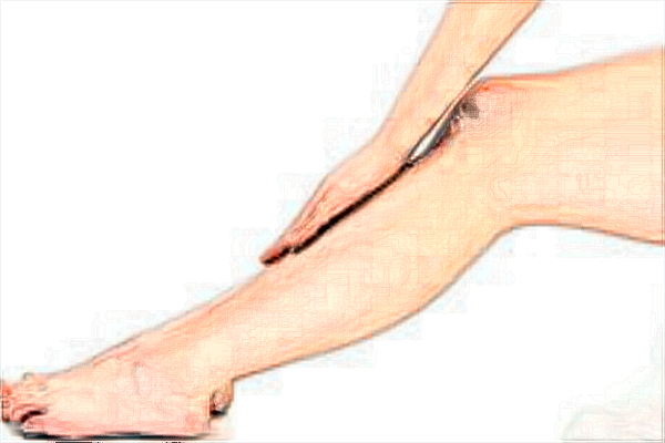 2024常州瘦小腿医院哪家好_瘦小腿价目表公布