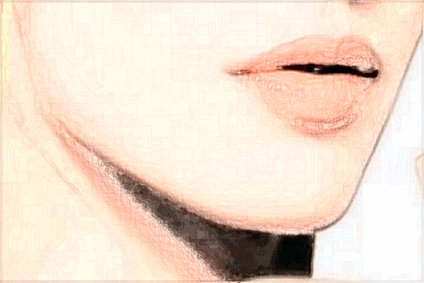 郑州天后垫下巴价格表2024?附垫下巴案例