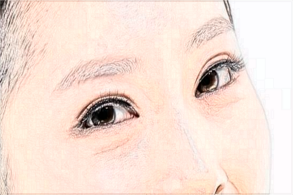 2024海口双眼皮医院排名_【医生推荐】