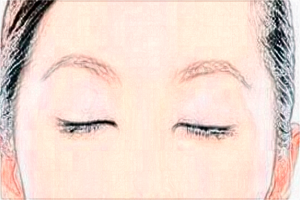 2024割双眼皮价目表公布_割双眼皮大概多久能恢复正常