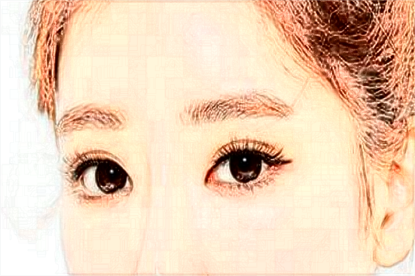 割双眼皮要注意的事项?割双眼皮要恢复多少天?