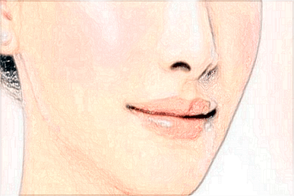 2024鞍鼻矫正价格表_鞍鼻矫正术需要住院吗