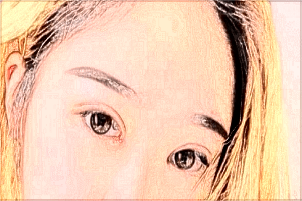 割双眼皮做哪种比较好?割双眼皮做提肌和不做的区别?