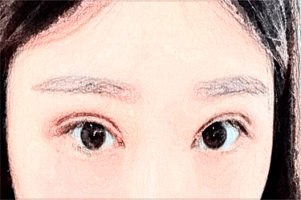割双眼皮有几种方法?割双眼皮有哪几种眼型?