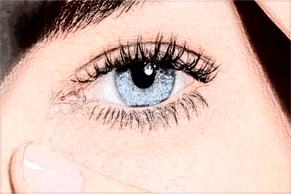 重庆市切开双眼皮价格表_2024切开双眼皮价格公示