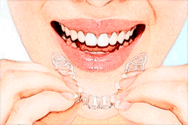 2024义乌牙齿矫正价目表_牙齿矫正的步骤和流程