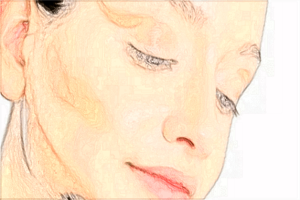 2024义乌鹰钩鼻矫正价格表(价目表)怎么样