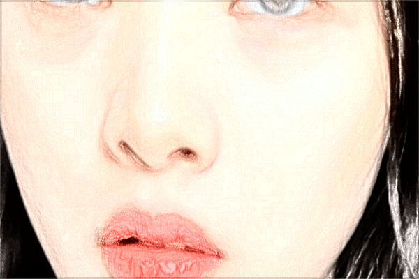 2024重庆联合丽格脂肪填充怎么样【附手术案例】