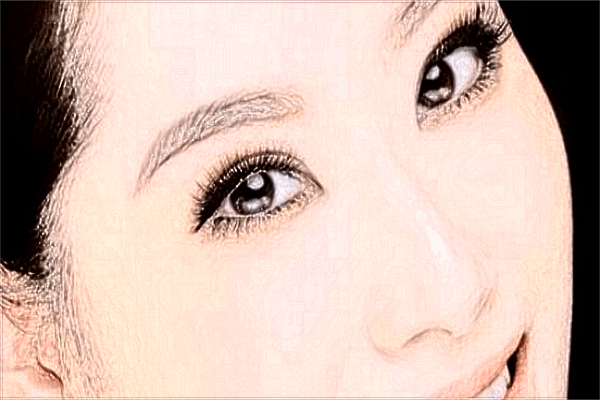 重庆联合丽格做双眼皮价目表【双眼皮案例】