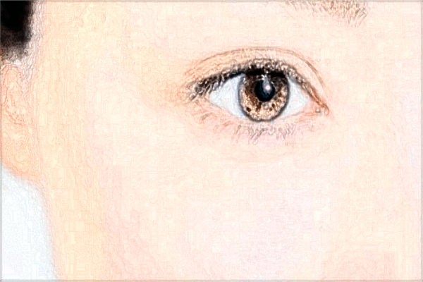 2024北京禾美嘉玻尿酸价格表(价目表)怎么样