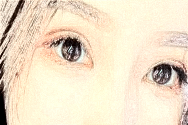 2024潮州华美割双眼皮怎么样_割双眼皮价目表