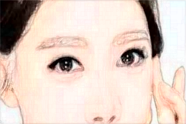 2024烟台洛神做眼袋哪位医生技术好_【附眼袋案例】