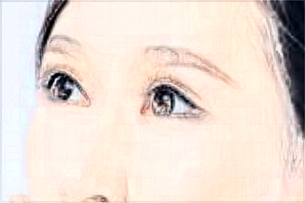 2024烟台洛神做眼袋哪位医生技术好_【附眼袋案例】