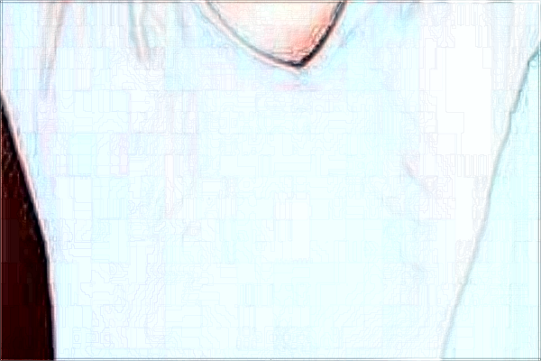 2024重庆联合丽格徐铎技术怎么样【附手术案例】