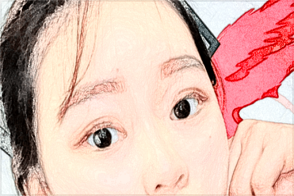 潮州哪里可以做双眼皮?做的好吗?