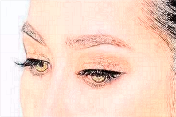 2024北京协和医院做双眼皮大概多少钱_附医生名单