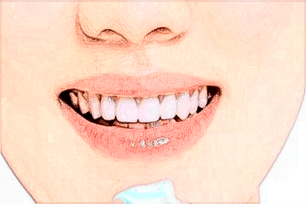 吉林省人民医院牙齿矫正怎么样_牙齿矫正价目表