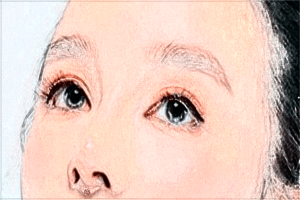 开内眼角会留疤吗(9月更新)_2024开内眼角收费价目表