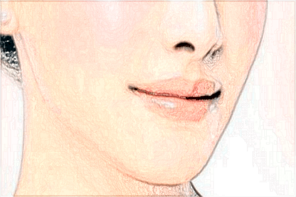 2024宁波市第一医院隆鼻整形价目表