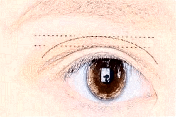 四川省中医院割双眼皮挂什么科?收费是多少