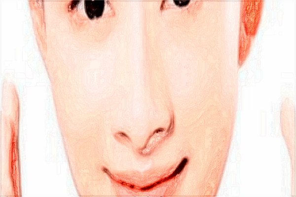 2024北京协和医院隆鼻大概多少钱_附医生名单