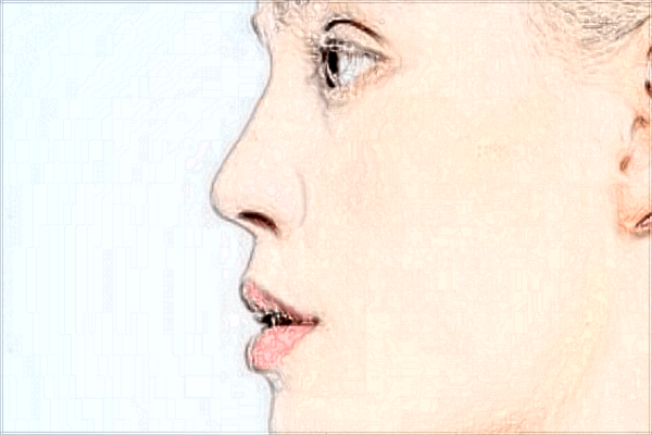 2024北京协和医院隆鼻大概多少钱_附医生名单