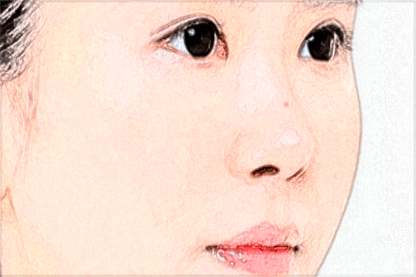 2024重庆联合丽格党宁技术怎么样【附手术案例】