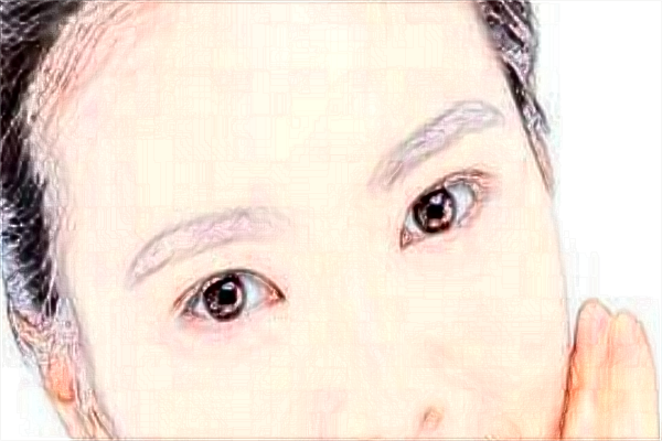 上海伊莱美做双眼皮怎么样_医生推荐