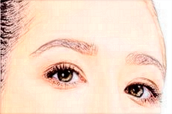 上海伊莱美做双眼皮怎么样_医生推荐