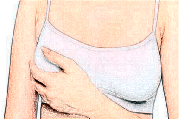 郑大一附院隆胸怎么样?2024隆胸收费价格