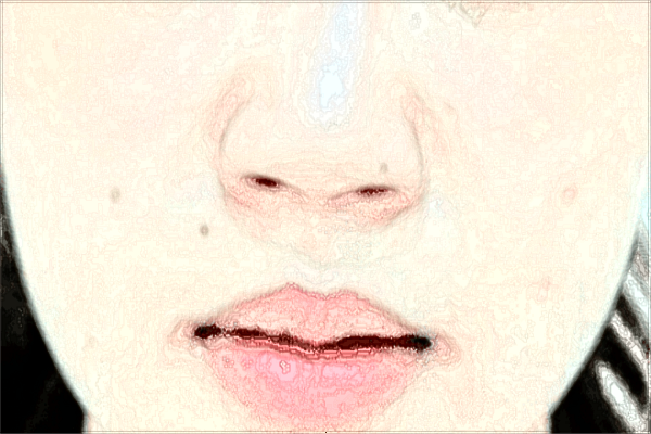 北京润美玉之光可以丰唇吗_医生技术怎么样