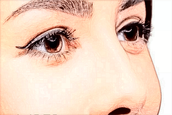 2024沈阳二院鼻翼减薄怎么样_鼻翼减薄是鼻翼缩小吗