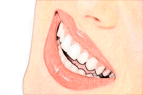 2024沈阳二院补牙价目表_补牙后需要做牙套吗