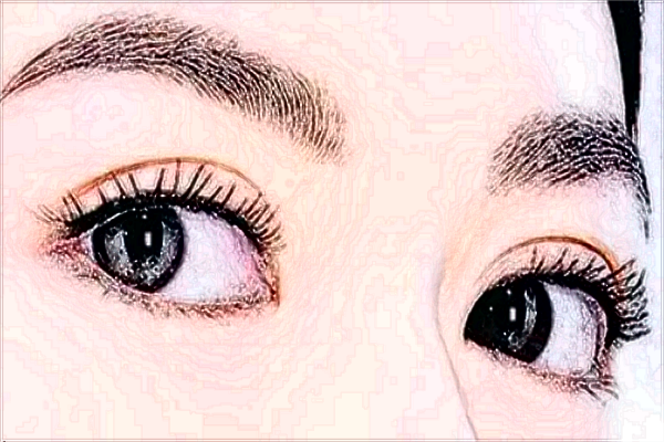 保定割双眼皮价目表(价格表)公布_医生名单