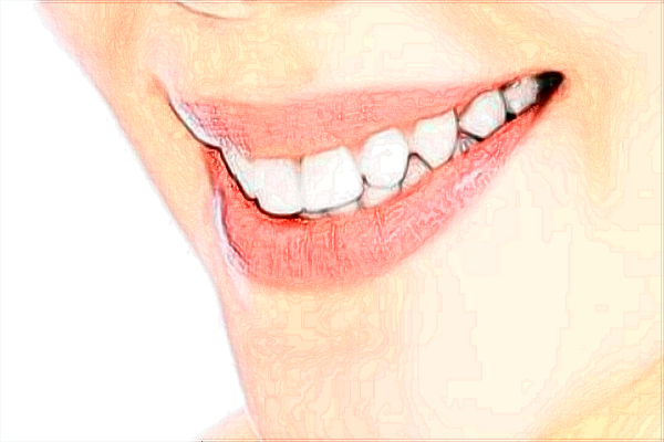 北京天坛医院补牙价目表(价格表)怎么样