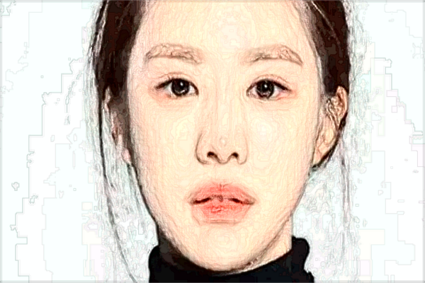 北京艺美自体脂肪丰卧蚕怎么样【附自体脂肪丰卧蚕案例】