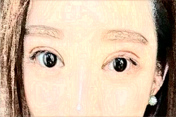 北京艺美脂肪隆鼻价目表(价格表)怎么样