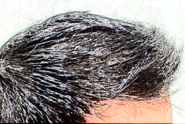 北京丽都植发怎么样_医生名单