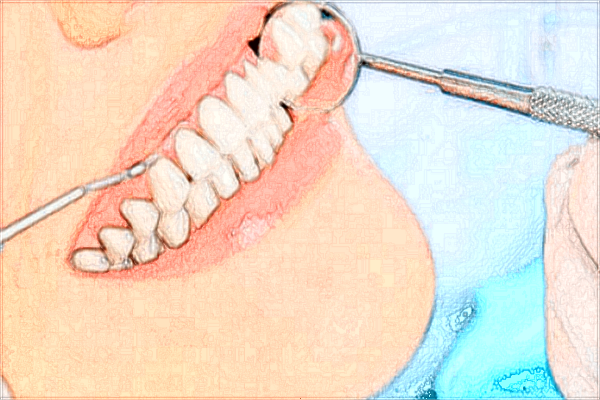 2024浙江医院种牙价格?单颗牙种植的费用