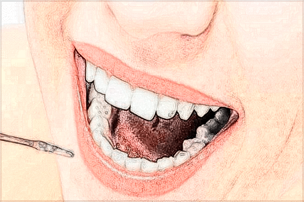 2021重庆解放军324医院口腔科牙齿美白怎么样_牙齿美白对牙齿有伤害吗